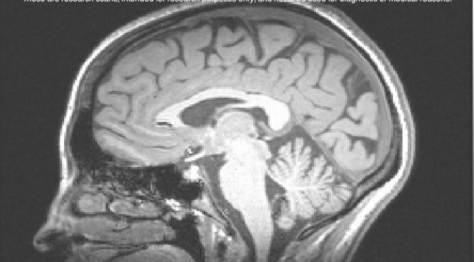 Being A Human Guinea Pig